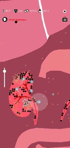 \